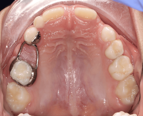 Odontopediatría en B&G Clínica Dental