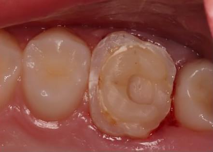 Tecnología en odontopediatría