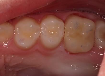 Consulta dental infantil