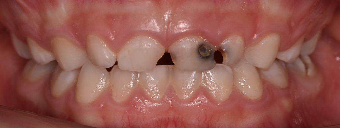 Atención odontopediátrica en Esparreguera