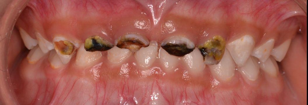 Equipo de odontopediatría